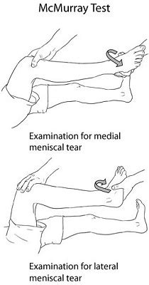 bob and brad meniscus tear test|bob and brad meniscus.